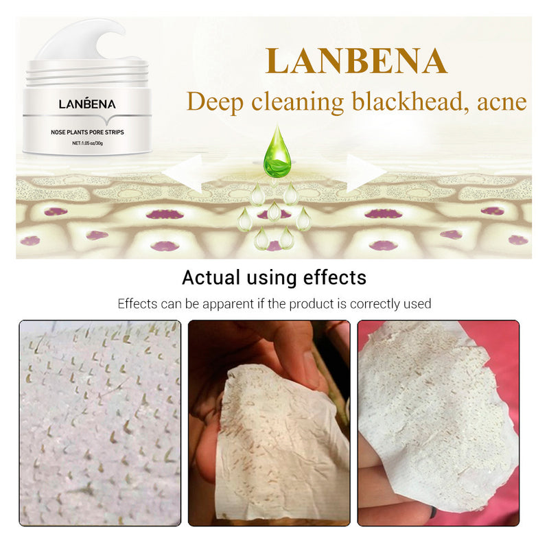 Blackhead Nose Strips